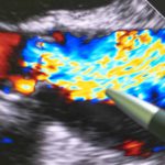Echocardiography available now and bulk-billed at Territory X-Ray Services image